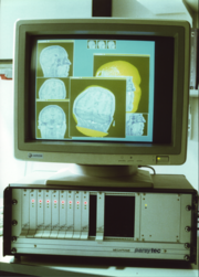Transputer Workstation zur medizinischen Bildverarbeitung 1990